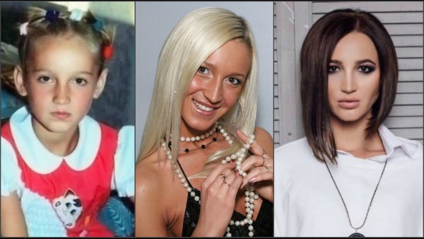 Olga Buzova - photos before and after plastic surgery of the nose, lips, cheekbones. How did I lose weight, what plastic surgery did I do