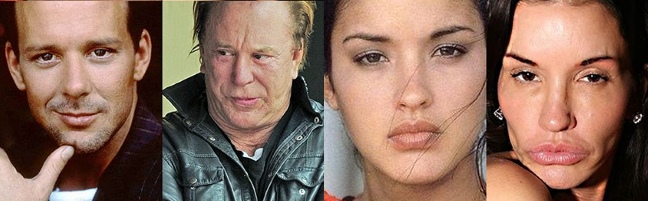 Unsuccessful plastic surgery. Photos of scary Russian and Hollywood stars, men and women