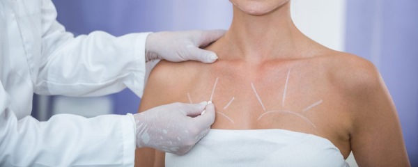 Breast plastic surgery. Indications of how the operation is performed with and without implants, results, photos, consequences