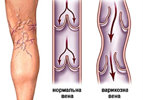 Breast plastic surgery. Indications of how the operation is performed with and without implants, results, photos, consequences