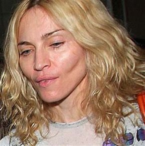 Unsuccessful plastic surgery. Photos of scary Russian and Hollywood stars, men and women