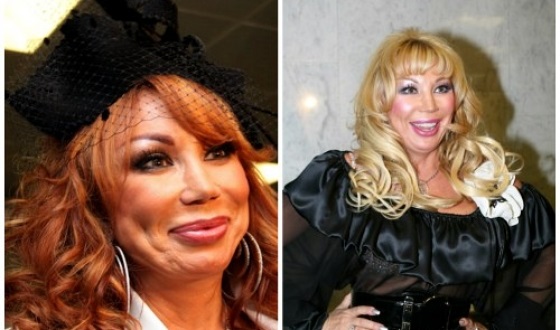 Unsuccessful plastic surgery. Photos of scary Russian and Hollywood stars, men and women