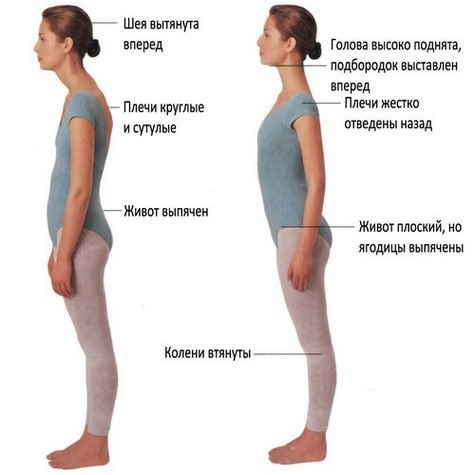 Exercises for back posture in the gym, at home for girls, women, teenagers. How to perform, pictures and videos