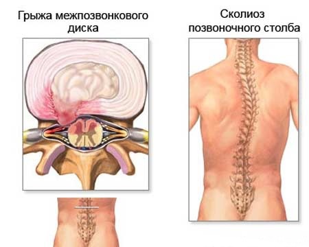 Exercises for back posture in the gym, at home for girls, women, teenagers. How to perform, pictures and videos