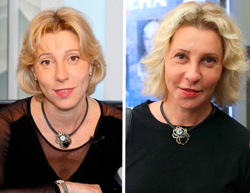 Rutberg Julia - plastic surgery, photos before and after plastic surgery of the face and nose. Biography and personal life