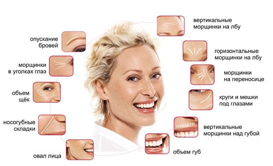 Juvederm-Hydrat zur Biorevitalisierung. Beschreibung des Arzneimittels, Zusammensetzung, Gebrauchsanweisung, Ergebnisse auf dem Foto, Preis, Bewertungen von Kosmetikerinnen