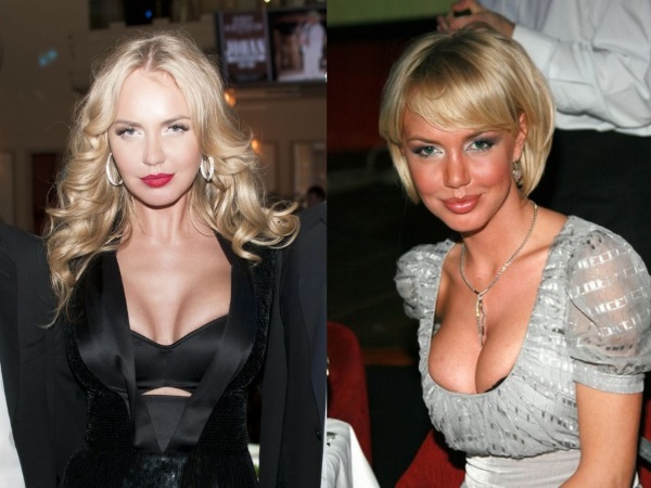 Plastic surgery victims: Russian celebrities and stars around the world, men and women. Before and after photos