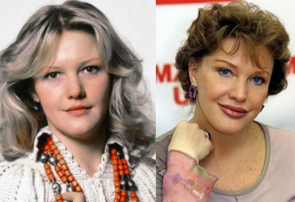 Plastic surgery victims: Russian celebrities and stars around the world, men and women. Before and after photos