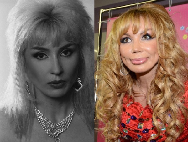 Plastic surgery victims: Russian celebrities and stars around the world, men and women. Before and after photos