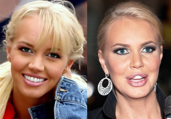 Plastic surgery victims: Russian celebrities and stars around the world, men and women. Before and after photos