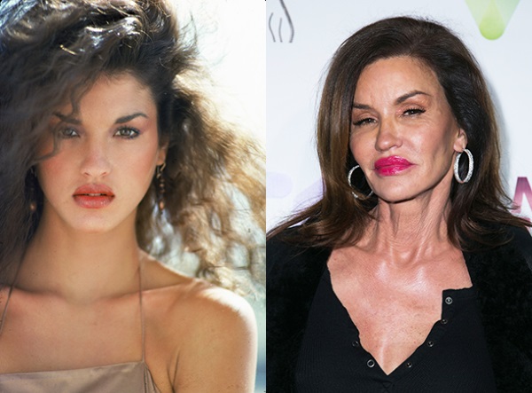 Plastic surgery victims: Russian celebrities and stars around the world, men and women. Before and after photos