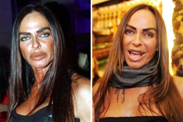 Plastic surgery victims: Russian celebrities and stars around the world, men and women. Before and after photos