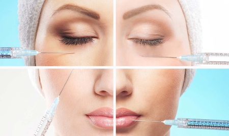 Fillers based on hyaluronic acid. Names, types, action, application effects, prices and reviews