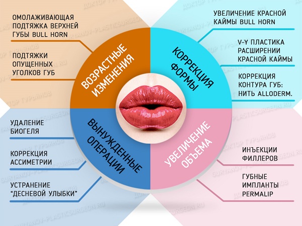 Cheiloplasty of the lips: before and after photos, types, indications and contraindications. How is the operation and rehabilitation going?