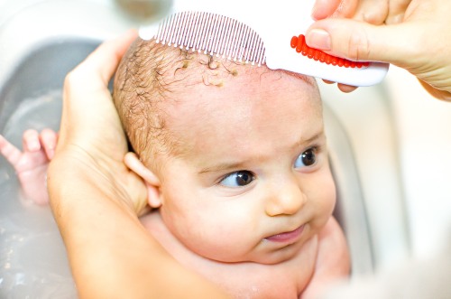 Come rimuovere la forfora dalla testa a casa in modo rapido ed efficace: shampoo medicati, oli, sale marino, soda