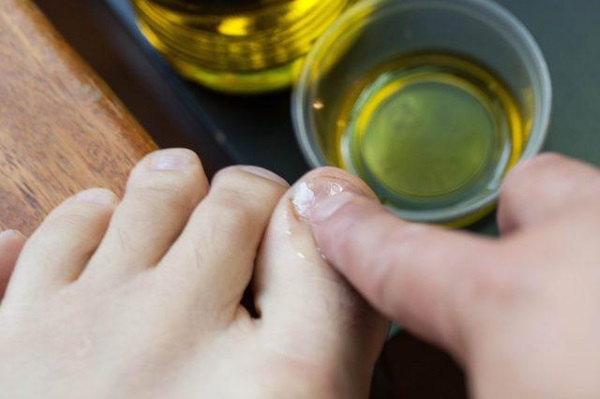 How to strengthen nails so that they do not exfoliate and do not break at home The reason for fragility, how to treat