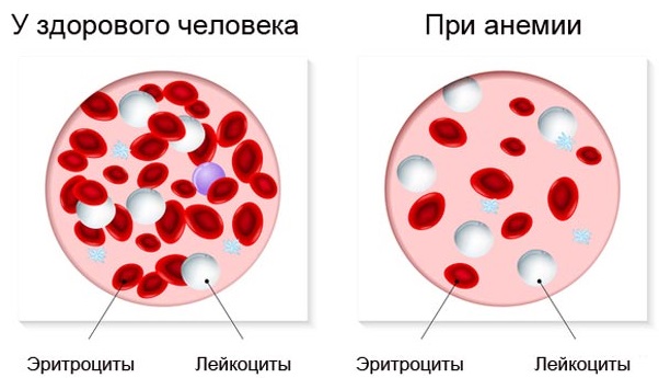 How to strengthen nails so that they do not exfoliate and do not break at home The reason for fragility, how to treat