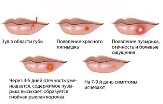 Ointments for scars and scars on the face after acne, chickenpox, blepharoplasty, surgery.Effective and inexpensive means