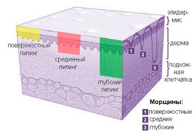 Mesotherapy and biorevitalization: what is the difference, benefits and harms after peeling, indications and contraindications