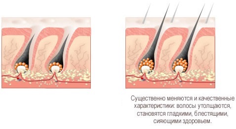 Acido nicotinico in compresse per capelli, maschere per la crescita. Istruzioni per l'uso, recensioni dei medici