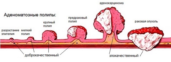 Hautneoplasmen: Fotos und Beschreibungen von Kopf, Armen, Gesicht und Körper. Wie man gutartige und bösartige Neubildungen behandelt