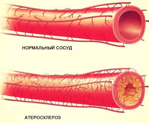 Intravenöse Ozontherapie. Bewertungen von Ärzten, Indikationen und Kontraindikationen, Nutzen und Schaden, Behandlungsverlauf, ist während der Schwangerschaft möglich