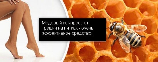 Rimedi per i talloni screpolati: gente con glicerina, ammoniaca, aceto, uova, perossido, aloe, vitamina E, calendula