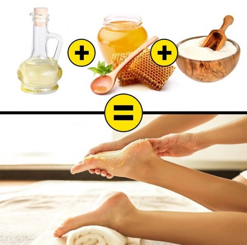 Remedies for cracked heels: folk with glycerin, ammonia, vinegar, egg, peroxide, aloe, vitamin E, calendula