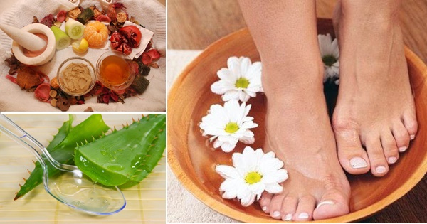 Remedies for cracked heels: folk with glycerin, ammonia, vinegar, egg, peroxide, aloe, vitamin E, calendula