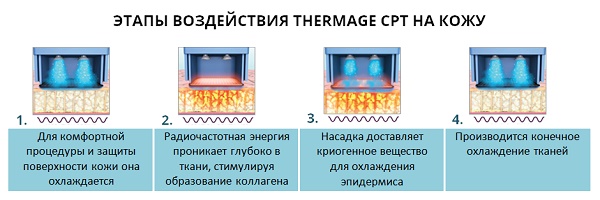 Facial thermage - what is this procedure, how is it done, what is the difference with RF-lifting. Photos, results, price, reviews