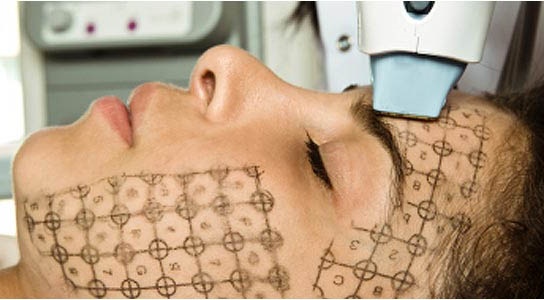 Facial thermage - what is this procedure, how is it done, what is the difference with RF-lifting. Photos, results, price, reviews