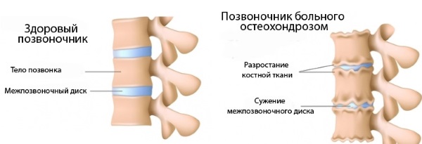 Rullo posteriore: ginepro, massaggio, sportivo, ortopedico, giapponese, rullo fitness cilindrico