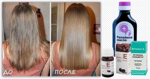 Capsule di vitamina E per capelli. Come usare in maschere, shampoo, risciacquo dei capelli, massaggio alla testa a casa