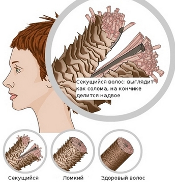 Vitamine contro la caduta dei capelli nelle donne. Valutazione dei migliori, elenco di economici, postpartum, con zinco e ferro