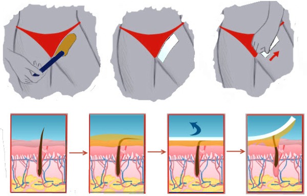 Wax depilation at home: bikini zones, legs, face, rules of conduct, wax strips, balls, granules, apparatus, creams, how to use