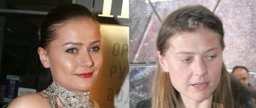 Stars without makeup - before and after photos: Russian artists, singers, what they look like without Photoshop