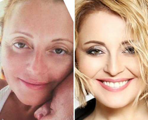 Stars without makeup - before and after photos: Russian artists, singers, what they look like without Photoshop