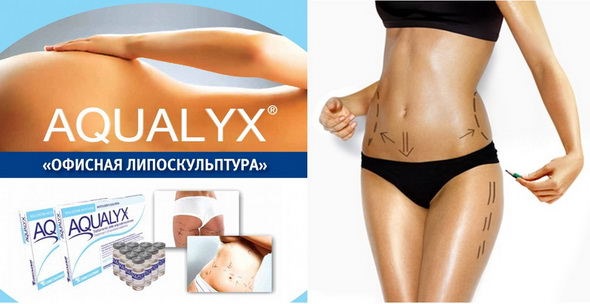 Aqualyx. Reviews, photos before and after. Composition, use in intralipotherapy. Price the price of an injection of a lipolytic drug, analogues