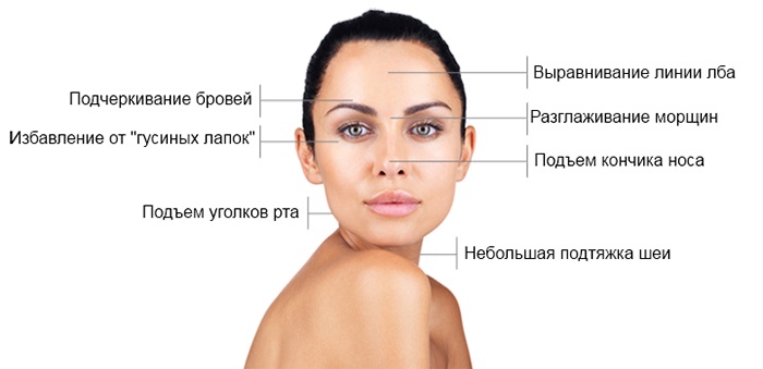 Botox injections for facial wrinkles. Before and after photos, price, consequences, contraindications of the procedure