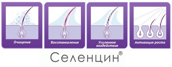 I migliori rimedi per la caduta dei capelli per le donne durante la gravidanza, l'allattamento, dopo il parto, la colorazione, la chemioterapia, lo squilibrio ormonale