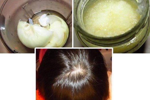 Hair mask with honey and egg, cognac, cinnamon, burdock oil for thickness and growth at home