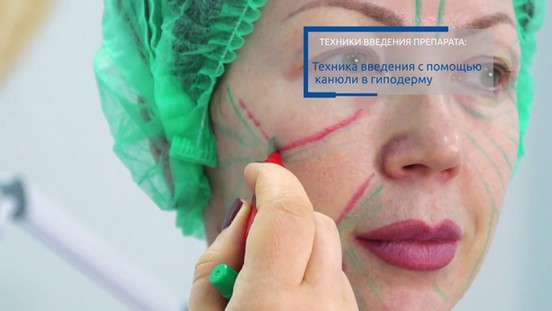 Mesovarton for face biorevitalization. Composition of the drug, manufacturer, consequences, reviews of cosmetologists and price