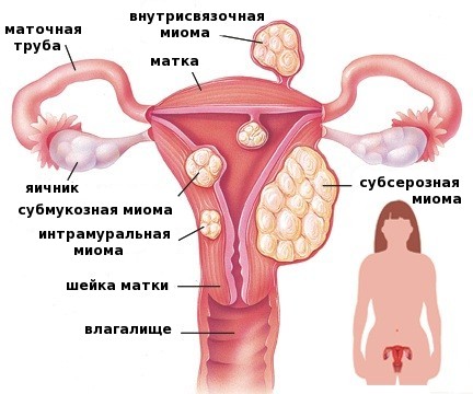 Why does the belly grow in women after 40, 50 years and how to remove it. Causes and remedies