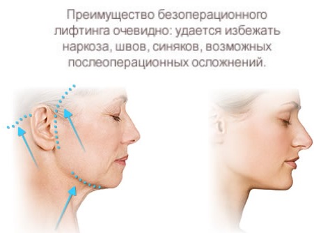 Facial plastic surgery. Photos before and after contouring surgery with hyaluronic acid. Prices, reviews