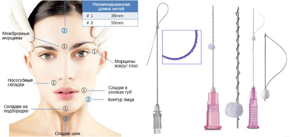 Facial plastic surgery. Photos before and after contouring surgery with hyaluronic acid. Prices, reviews