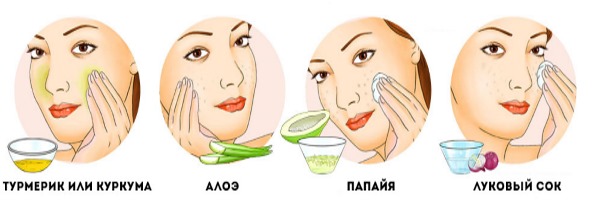 Remedies for age spots on the face and hands. Folk recipes, pharmacy preparations, creams: Melanativ, Vichy, Sabainang. How to apply