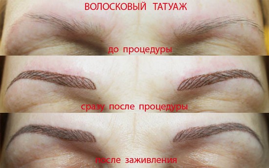 Eyebrow tattoo: hair method. Advantages and disadvantages, contraindications, performance features, before and after photos