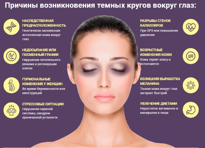 Dark bags under the eyes, circles around the eyes. Causes and treatment in women and men