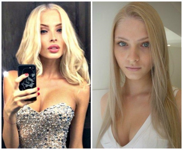 Alena Shishkova. Photos before and after plastic surgery. Biography, model operations, figure parameters