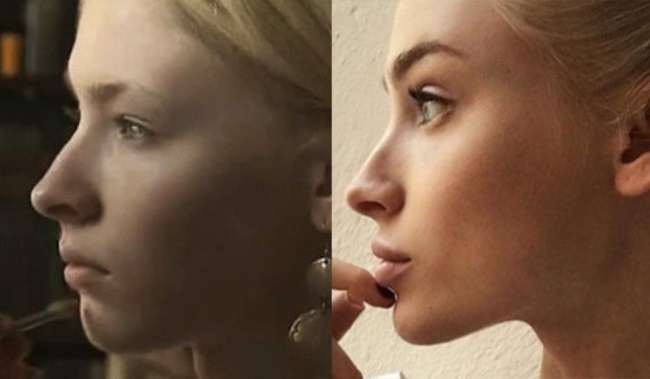 Alena Shishkova. Photos before and after plastic surgery. Biography, model operations, figure parameters